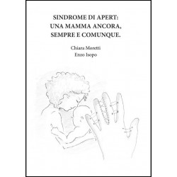 SINDROME DI APERT