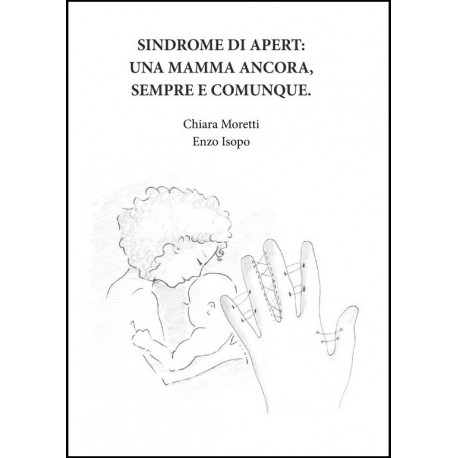 SINDROME DI APERT